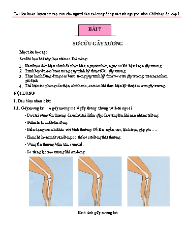 Tài liệu Huấn luyện sơ cấp cứu cho người dân - Bài 7: Sơ cứu gãy xương